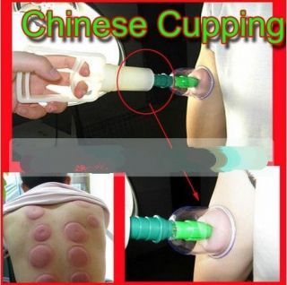 Chinese Medical 12 Body Cupping Set+6 magnets Point New