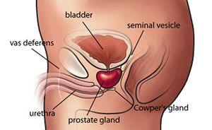 man with prostate cancer may not have any symptoms