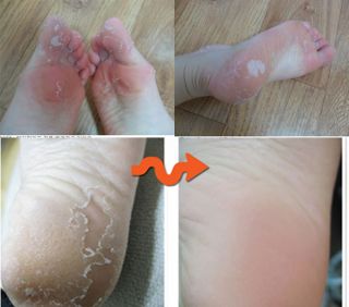 Foot Care Peeling Tonymoly Shiny Liquid 20MLX2PACK Baby Exfoliation