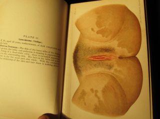 RARE 1900 Book Skin Diseases Loaded with Color Prints