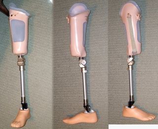 Prosthetic Right Leg   Above the Knee w Cable Release Knee   Excellent