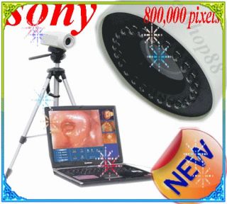 New Digital Video Sony 850,000 Electronic Colposcope 2012 new version